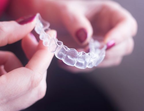 How Much Does Invisalign Cost? For Me, $1,050
